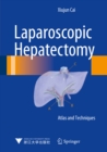 Laparoscopic Hepatectomy : Atlas and Techniques - eBook