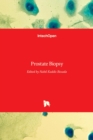 Prostate Biopsy - Book