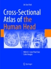 Cross-Sectional Atlas of the Human Head : With 0.1-mm pixel size color images - Book