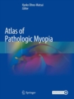 Atlas of Pathologic Myopia - Book
