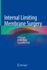Internal Limiting Membrane Surgery - Book