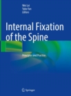 Internal Fixation of the Spine : Principles and Practice - Book