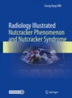 Radiology Illustrated: Nutcracker Phenomenon and Nutcracker Syndrome - Book