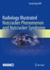 Radiology Illustrated: Nutcracker Phenomenon and Nutcracker Syndrome - Book