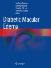 Diabetic Macular Edema - Book