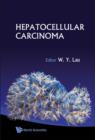 Hepatocellular Carcinoma - Book