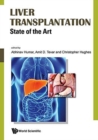 Liver Transplantation: State Of The Art - Book