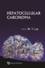 Hepatocellular Carcinoma - eBook