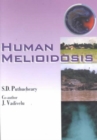 Human Melioidosis - Book