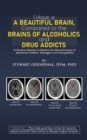I Have a Beautiful Brain, Compared to the Brains of Alcoholics and Drug Addicts : A Sincere Attempt to Reduce the Attractiveness of Alcohol for Children, Teenagers, and Young Adults - eBook