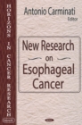 New Research On Esophageal Cancer - eBook