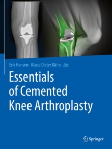 Essentials of Cemented Knee Arthroplasty
