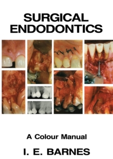 Surgical Endodontics : A Colour Manual