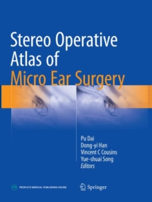Stereo Operative Atlas of Micro Ear Surgery