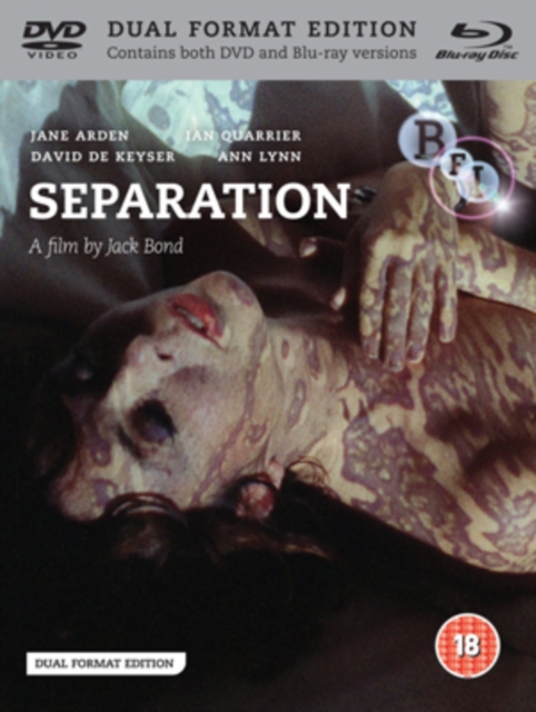 Separation, DVD  DVD