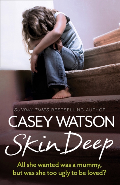 Skin Deep : All She Wanted Was a Mummy, but Was She Too Ugly to be Loved?, Paperback / softback Book