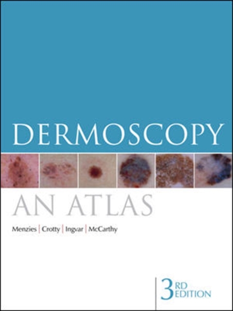 Dermoscopy, Paperback / softback Book
