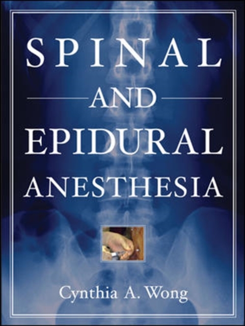 Spinal and Epidural Anesthesia, Hardback Book