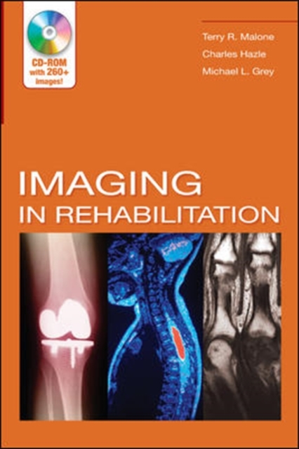 Imaging In Rehabilitation, Paperback / softback Book