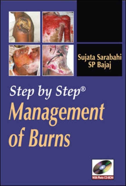 Step by Step Management of Burns, DVD video Book