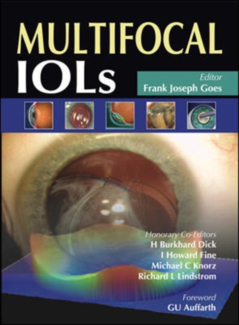 Multifocal IOLs, Hardback Book