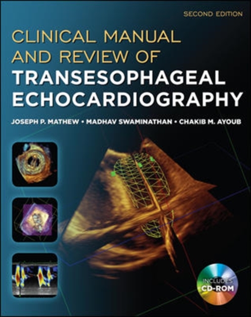 Clinical Manual and Review of Transesophageal Echocardiography, Second Edition, Book Book