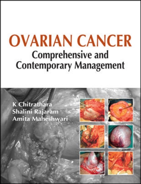 Ovarian Cancer: Comprehensive and Contemporary Management, Hardback Book