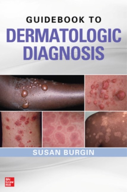 Guidebook to Dermatologic Diagnosis, Paperback / softback Book