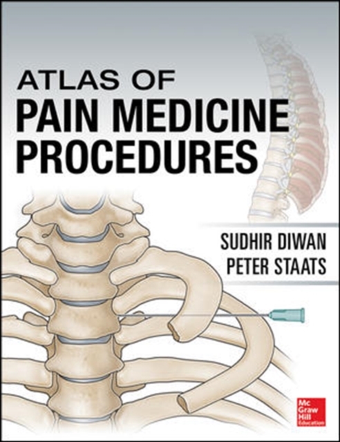Atlas of Pain Medicine Procedures, Hardback Book