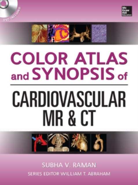 Color Atlas and Synopsis of Cardiovascular MR and CT (SET 2), Book Book