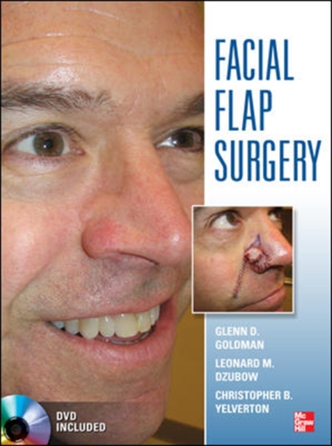 Facial Flaps Surgery, Book Book