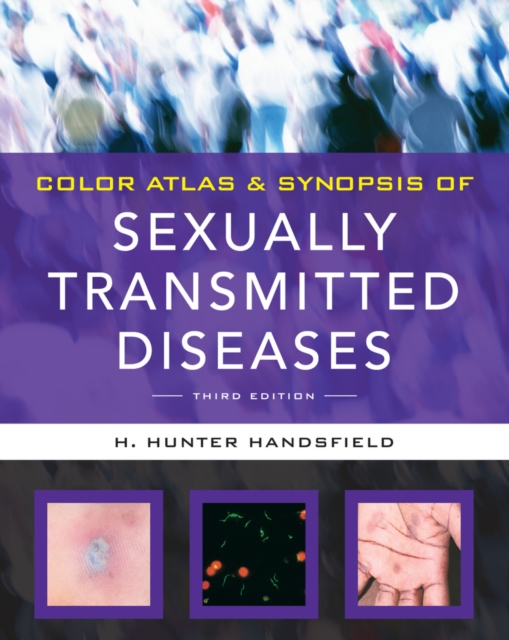 Color Atlas & Synopsis of Sexually Transmitted Diseases, Third Edition, PDF eBook