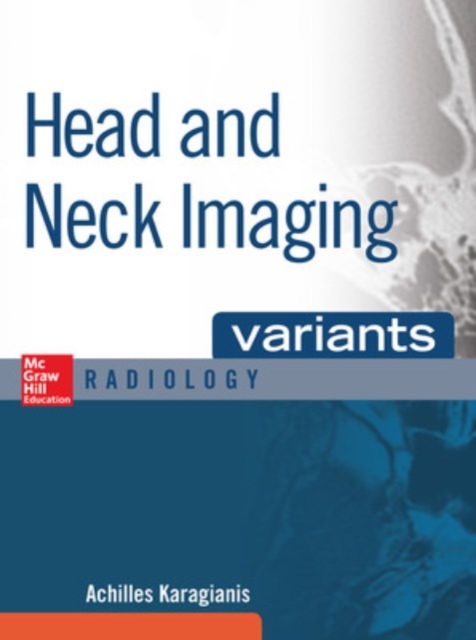 Head and Neck Imaging Variants, Hardback Book
