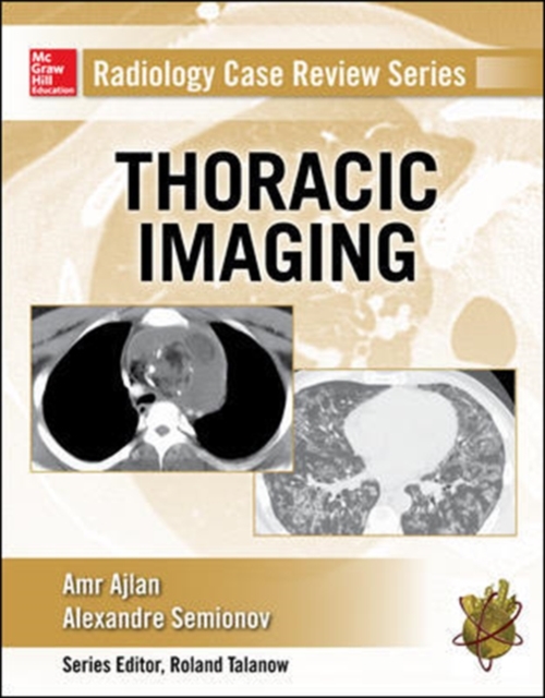 Radiology Case Review Series: Thoracic Imaging, Paperback / softback Book