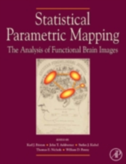 Statistical Parametric Mapping: The Analysis of Functional Brain Images, PDF eBook