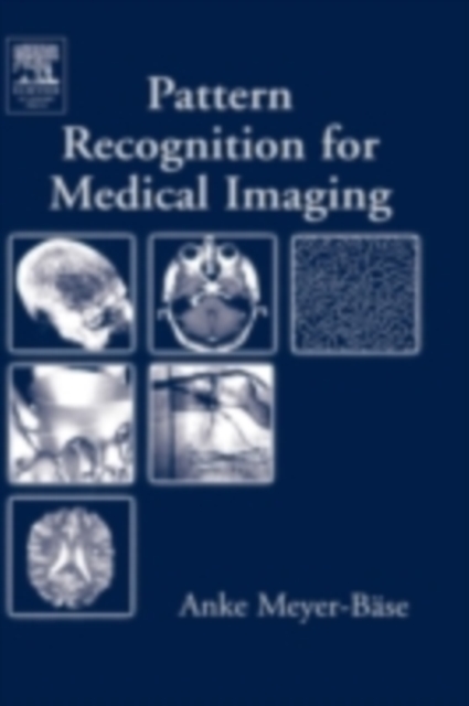 Pattern Recognition and Signal Analysis in Medical Imaging, PDF eBook