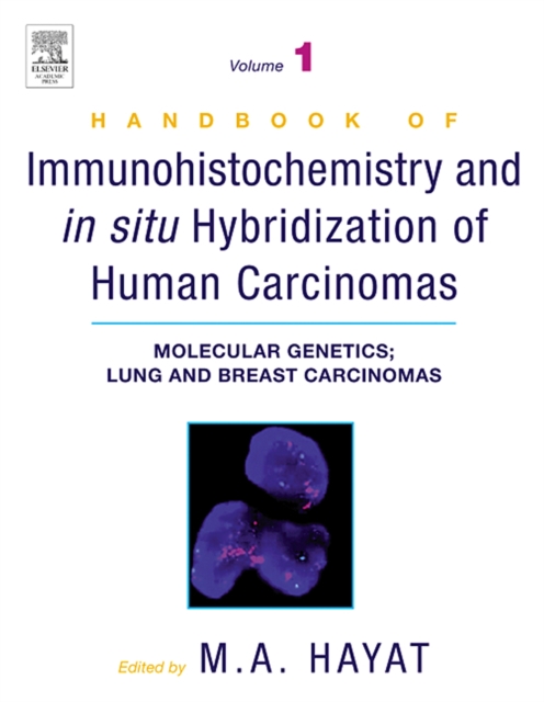 Handbook of Immunohistochemistry and in Situ Hybridization of Human Carcinomas : Molecular Genetics; Lung and Breast Carcinomas, PDF eBook