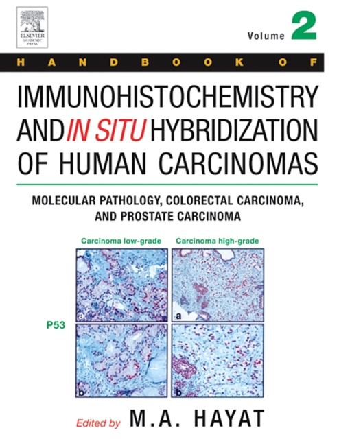 Handbook of Immunohistochemistry and in Situ Hybridization of Human Carcinomas : Molecular Pathology, Colorectal Carcinoma, and Prostate Carcinoma, PDF eBook