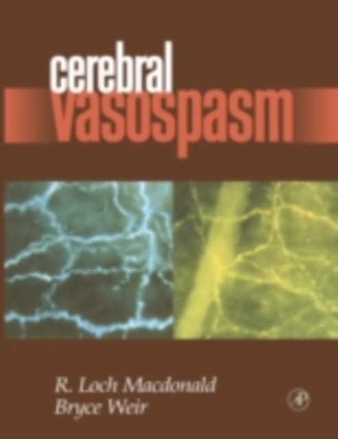 Cerebral Vasospasm, PDF eBook