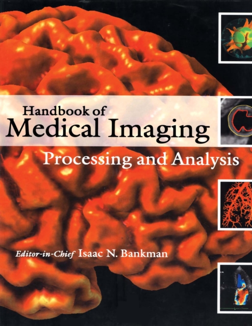 Handbook of Medical Imaging : Processing and Analysis Management, PDF eBook