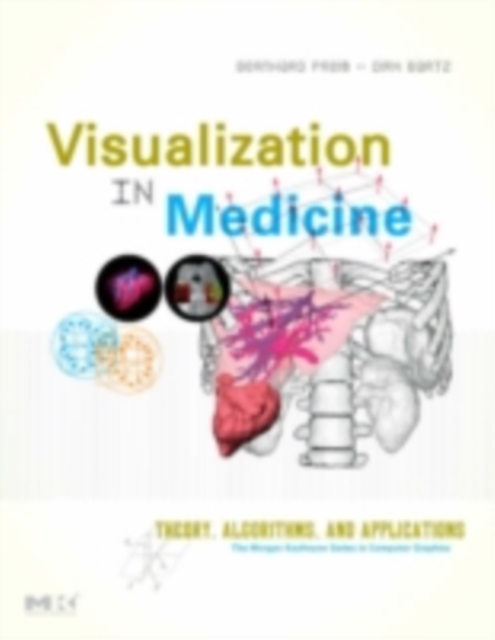 Visualization in Medicine : Theory, Algorithms, and Applications, PDF eBook