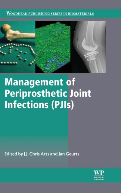 Management of Periprosthetic Joint Infections (PJIs), Hardback Book