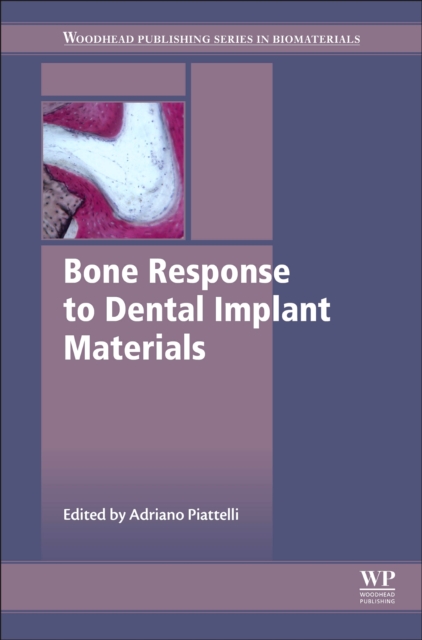Bone Response to Dental Implant Materials, PDF eBook