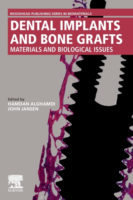 Dental Implants and Bone Grafts : Materials and Biological Issues, Paperback / softback Book