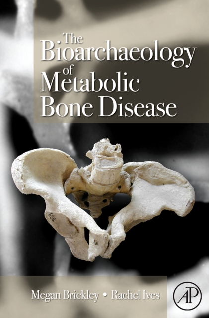 The Bioarchaeology of Metabolic Bone Disease, Hardback Book