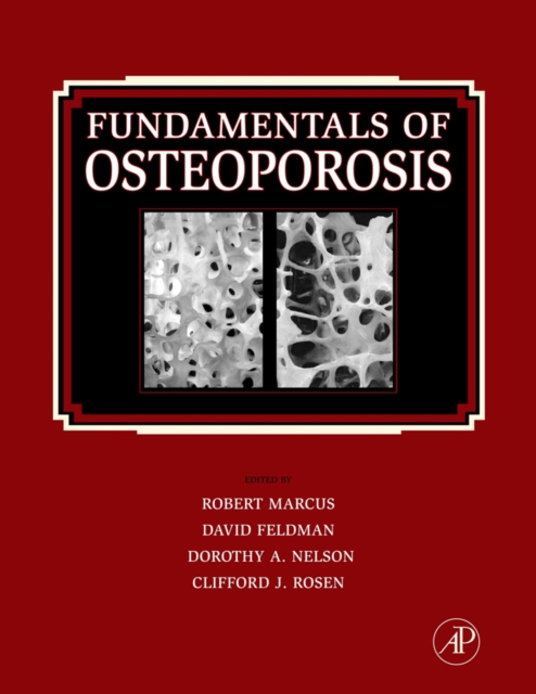 Fundamentals of Osteoporosis, Hardback Book
