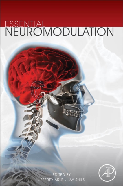 Essential Neuromodulation, PDF eBook