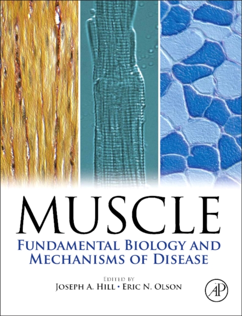 Muscle 2-Volume Set : Fundamental Biology and Mechanisms of Disease, Multiple-component retail product Book