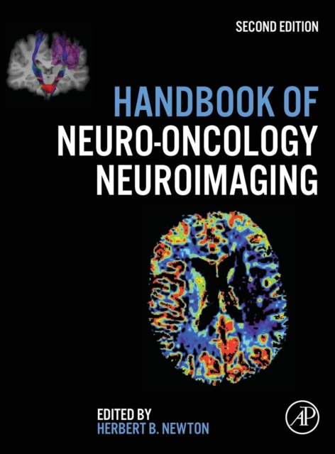 Handbook of Neuro-Oncology Neuroimaging, Hardback Book