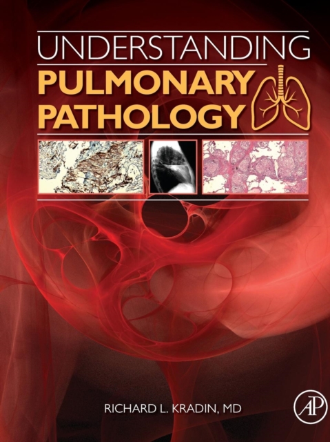 Understanding Pulmonary Pathology : Applying Pathological Findings in Therapeutic Decision Making, Paperback / softback Book